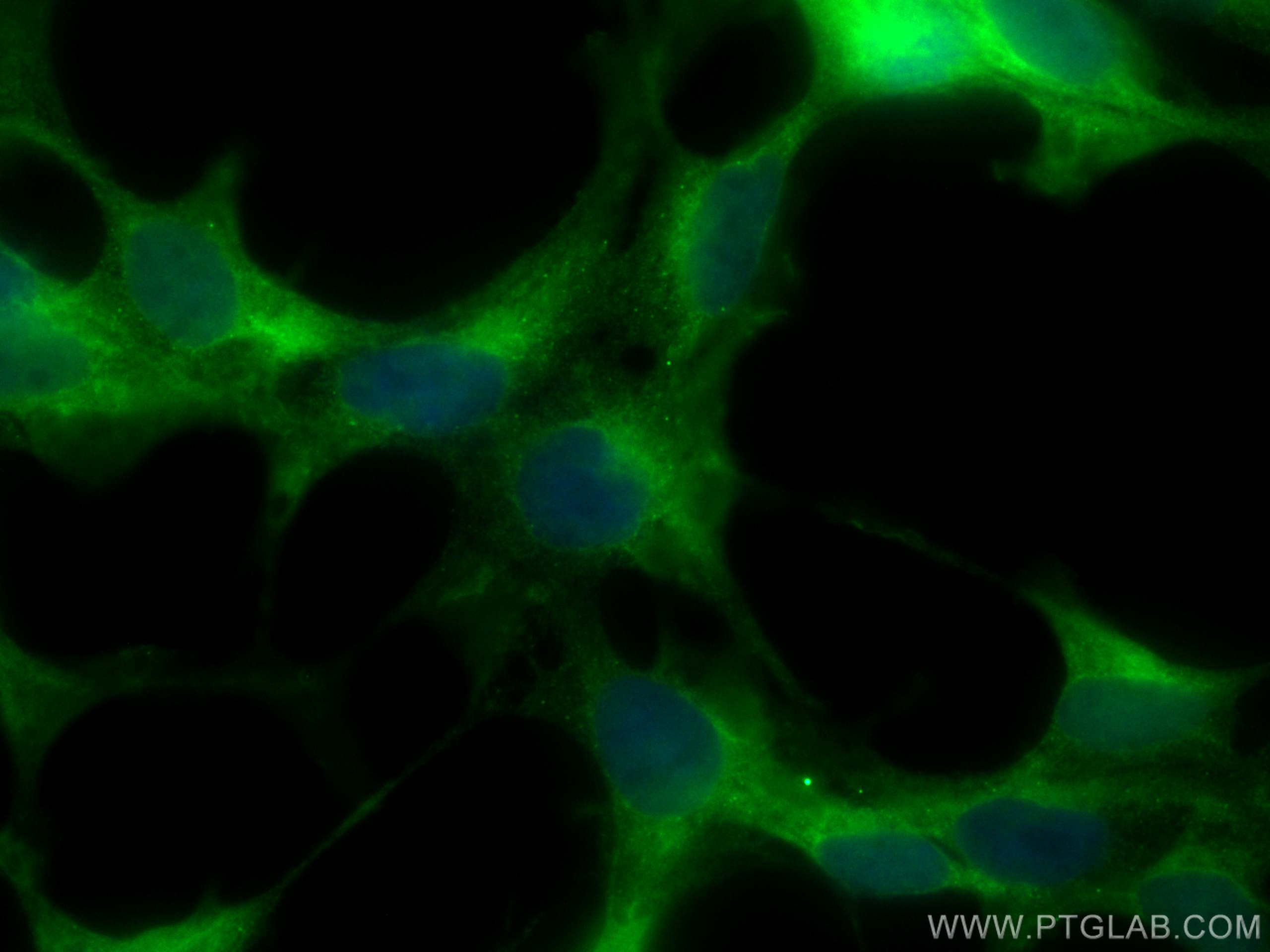 Immunofluorescence (IF) / fluorescent staining of HEK-293 cells using CoraLite® Plus 488-conjugated CACYBP Monoclonal an (CL488-68161)