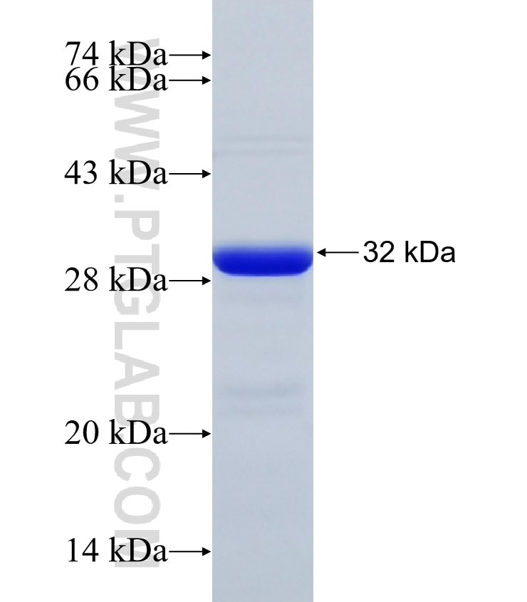 CACYBP fusion protein Ag32734 SDS-PAGE CACYBP fusion protein Ag32734 SDS-PAGE