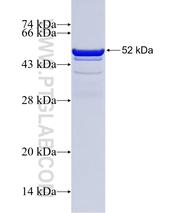 CACYBP fusion protein Ag2340 SDS-PAGE