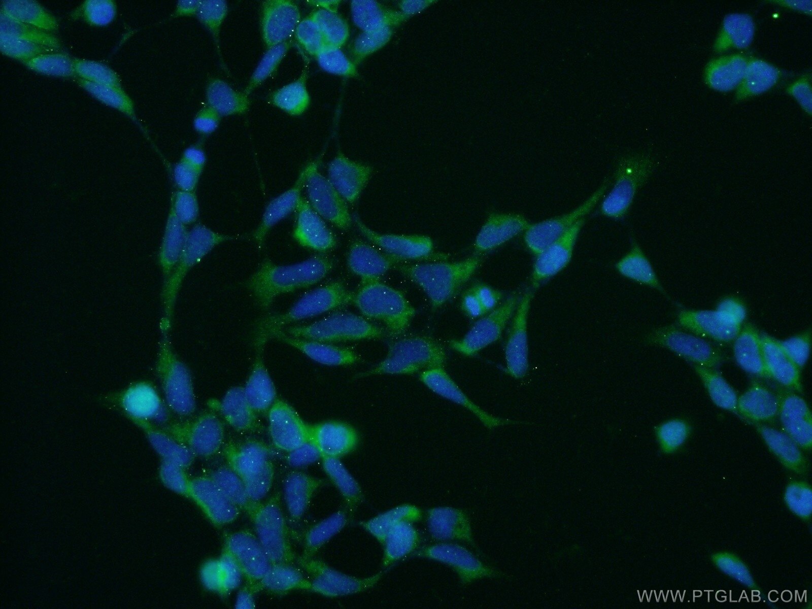 Immunofluorescence (IF) / fluorescent staining of HEK-293 cells using CAD Polyclonal antibody (16617-1-AP)