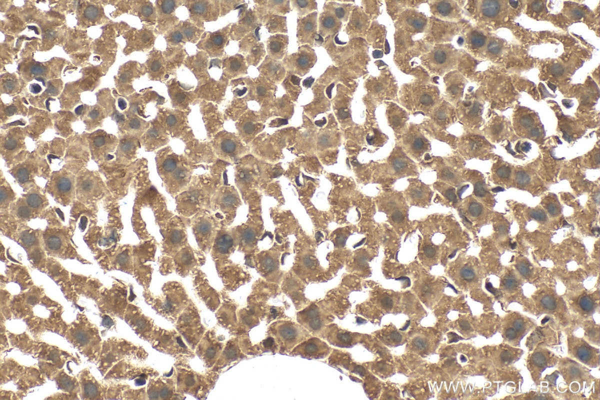 Immunohistochemistry (IHC) staining of mouse liver tissue using CAD Polyclonal antibody (16617-1-AP)