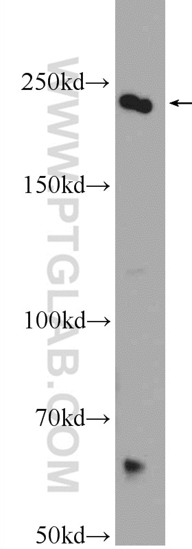 Western Blot (WB) analysis of HEK-293 cells using CAD Polyclonal antibody (16617-1-AP)