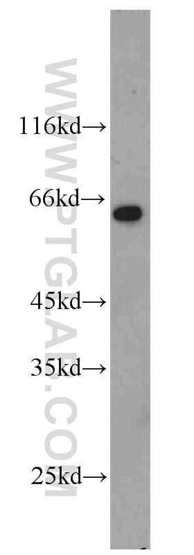 Western Blot (WB) analysis of A549 cells using CADM1 Polyclonal antibody (14335-1-AP)