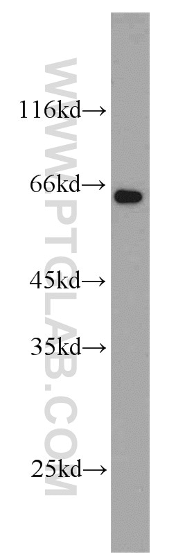 Western Blot (WB) analysis of mouse lung tissue using CADM1 Polyclonal antibody (14335-1-AP)