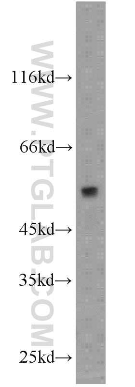 Western Blot (WB) analysis of human placenta tissue using CADM1 Polyclonal antibody (14335-1-AP)