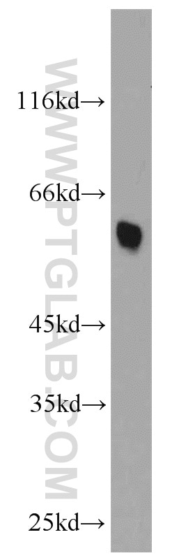 Western Blot (WB) analysis of mouse liver tissue using CADM1 Polyclonal antibody (14335-1-AP)