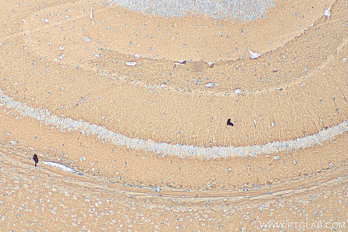 Immunohistochemistry (IHC) staining of mouse brain tissue using CADM2 Polyclonal antibody (17773-1-AP)