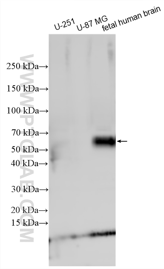 Western Blot (WB) analysis of various lysates using CADM2 Polyclonal antibody (17773-1-AP)