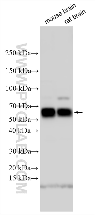 Western Blot (WB) analysis of various lysates using CADM2 Polyclonal antibody (17773-1-AP)