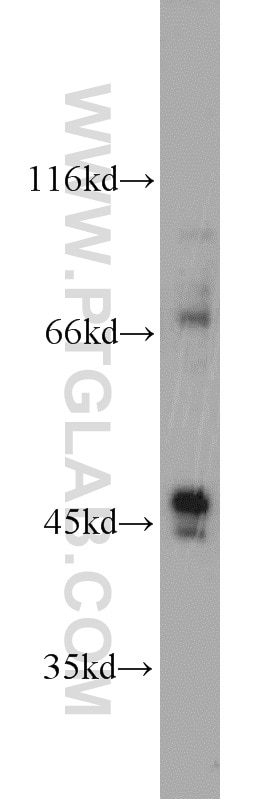Western Blot (WB) analysis of SH-SY5Y cells using CADM3 Polyclonal antibody (15660-1-AP)