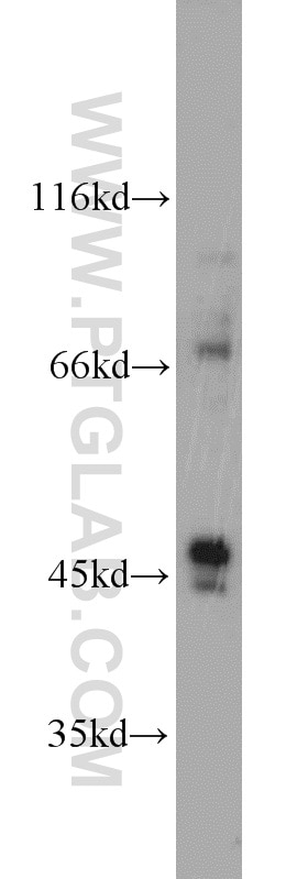 WB analysis of SH-SY5Y using 15660-1-AP