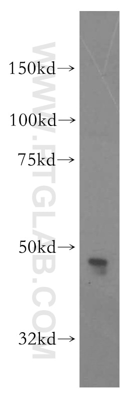 Western Blot (WB) analysis of Jurkat cells using CADM3 Polyclonal antibody (15660-1-AP)