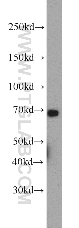 Western Blot (WB) analysis of COLO 320 cells using CADM4 Polyclonal antibody (23136-1-AP)