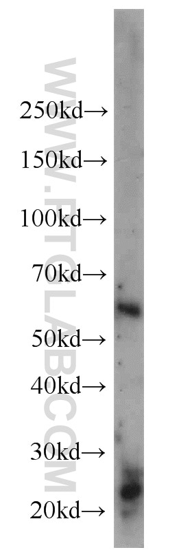 Western Blot (WB) analysis of mouse lung tissue using CADM4 Polyclonal antibody (23136-1-AP)
