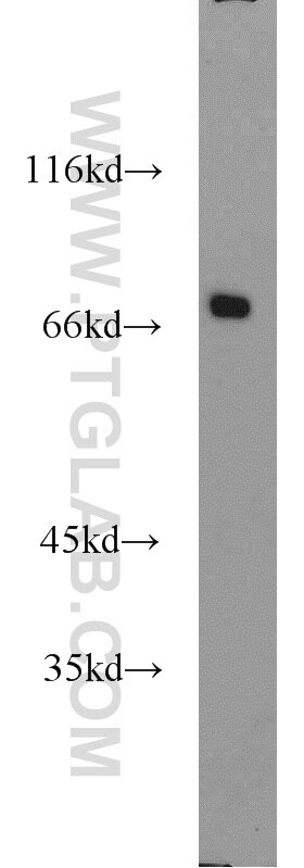 Western Blot (WB) analysis of RAW264.7 using CADM4 Polyclonal antibody (23136-1-AP)