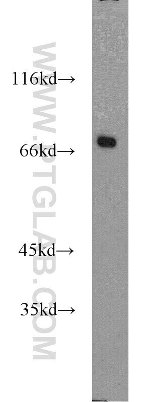 Western Blot (WB) analysis of RAW264.7 using CADM4 Polyclonal antibody (23136-1-AP)