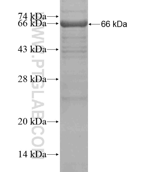 CADM4 fusion protein Ag18922 SDS-PAGE