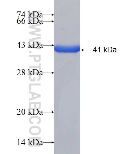 CADM4 fusion protein Ag18945 SDS-PAGE