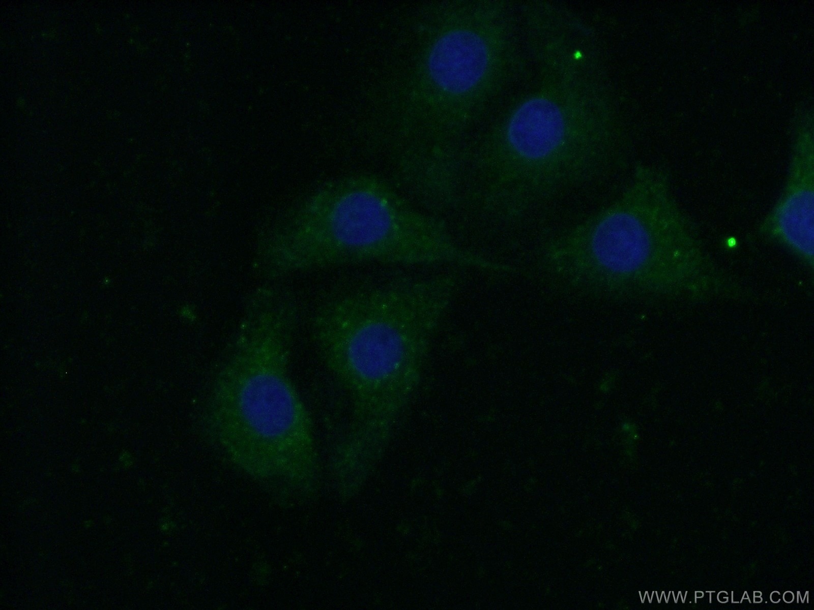 Immunofluorescence (IF) / fluorescent staining of SH-SY5Y cells using CAPS1 Polyclonal antibody (11490-2-AP)