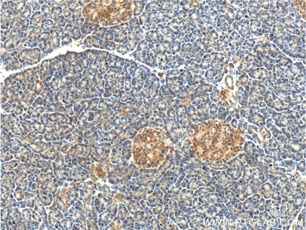 Immunohistochemistry (IHC) staining of human pancreas tissue using CAPS1 Polyclonal antibody (11490-2-AP)