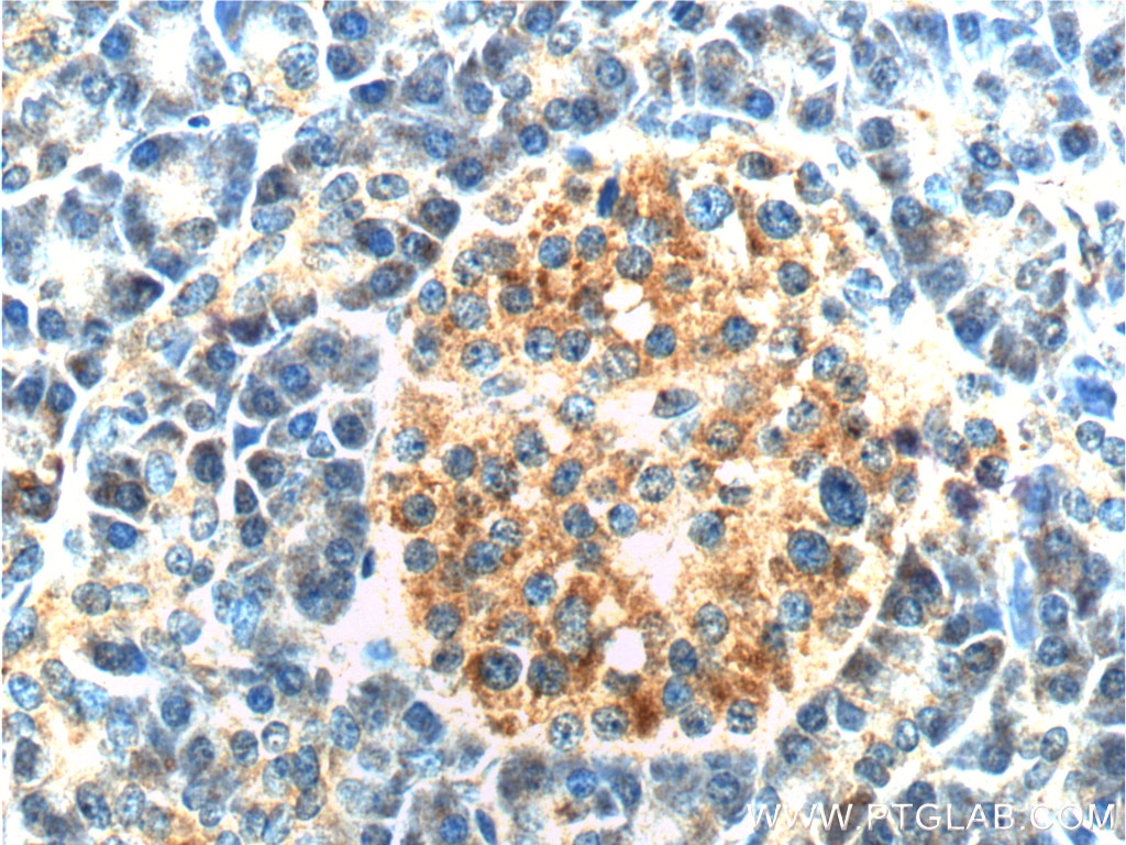 Immunohistochemistry (IHC) staining of human pancreas tissue using CAPS1 Polyclonal antibody (11490-2-AP)