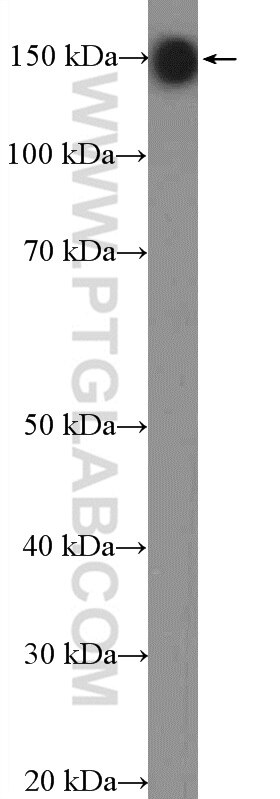 Western Blot (WB) analysis of rat brain tissue using CAPS1 Polyclonal antibody (11490-2-AP)