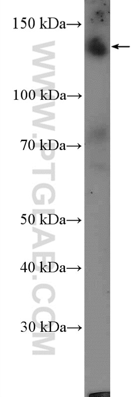 Western Blot (WB) analysis of mouse brain tissue using CAPS1 Polyclonal antibody (11490-2-AP)