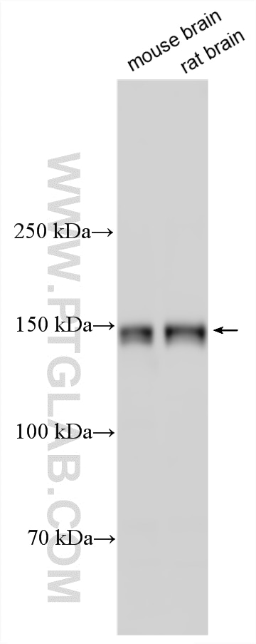 Various lysates were subjected to SDS PAGE followed by western blot with 11490-2-AP (CAPS1 antibody) at dilution of 1:3000 incubated at room temperature for 1.5 hours. Western Blot (WB) analysis of various lysates using CAPS1 Polyclonal antibody (11490-2-AP)