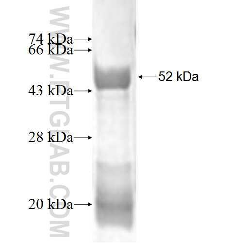 CADPS fusion protein Ag1975 SDS-PAGE
