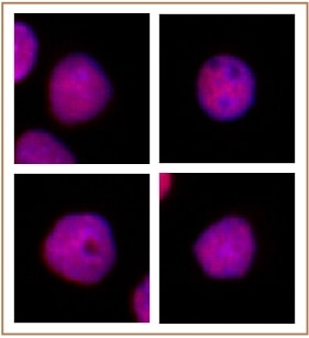 p60 CAF1 (F13) Rabbit mAb main image 1