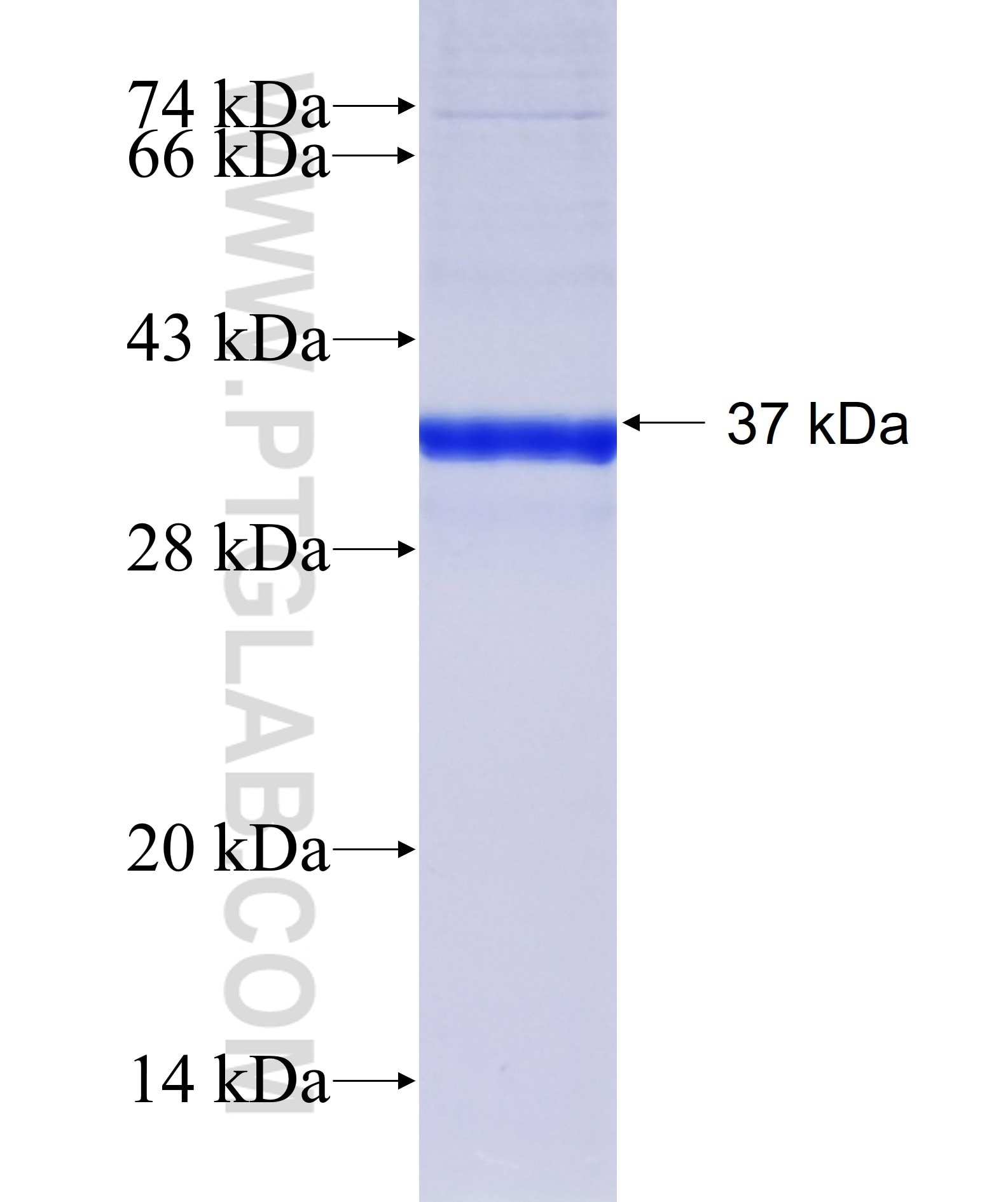 CAGE1 fusion protein Ag40753 SDS-PAGE CAGE1 fusion protein Ag40753 SDS-PAGE
