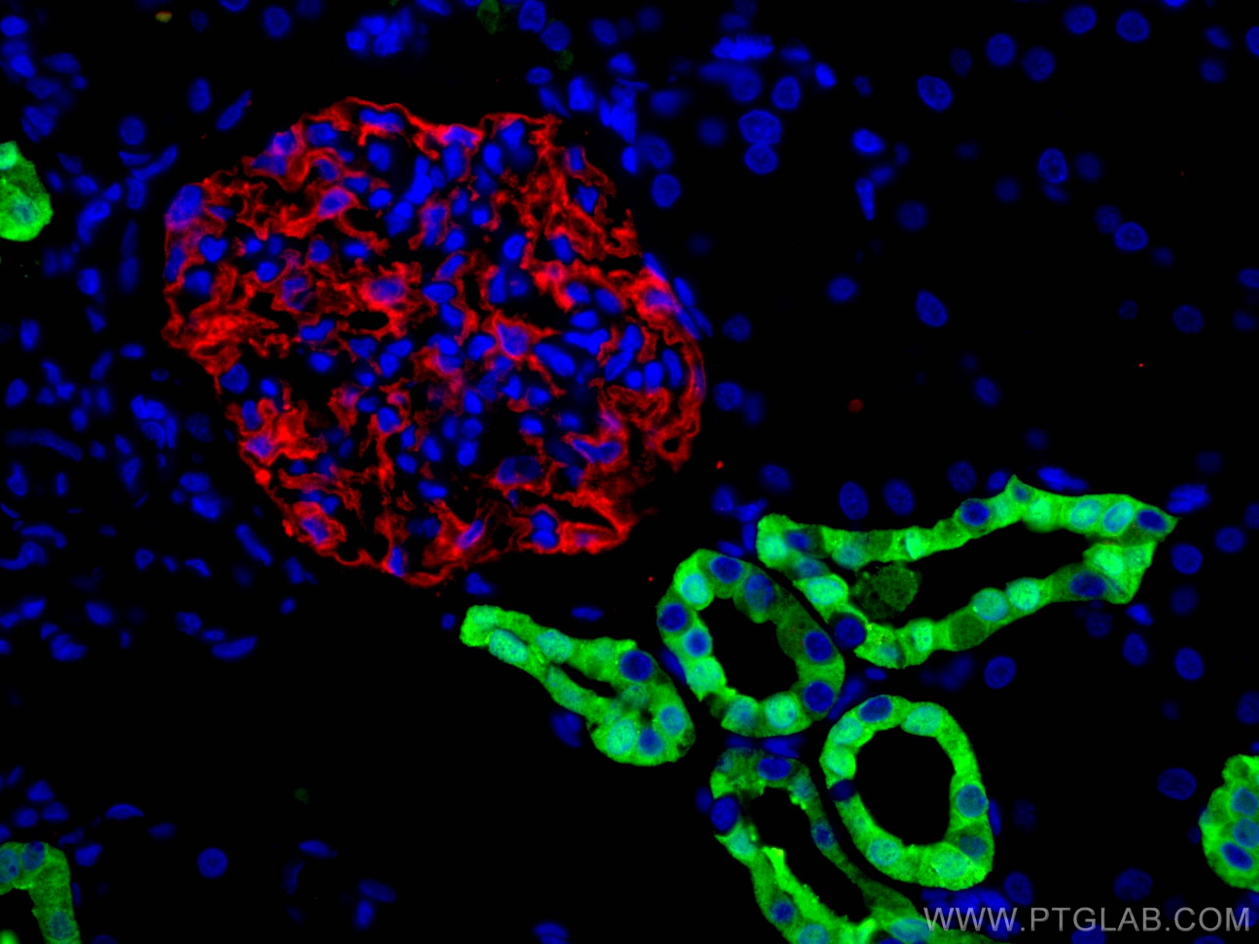 Immunofluorescence (IF) / fluorescent staining of human kidney tissue using Calbindin-D28k Polyclonal antibody (14479-1-AP)