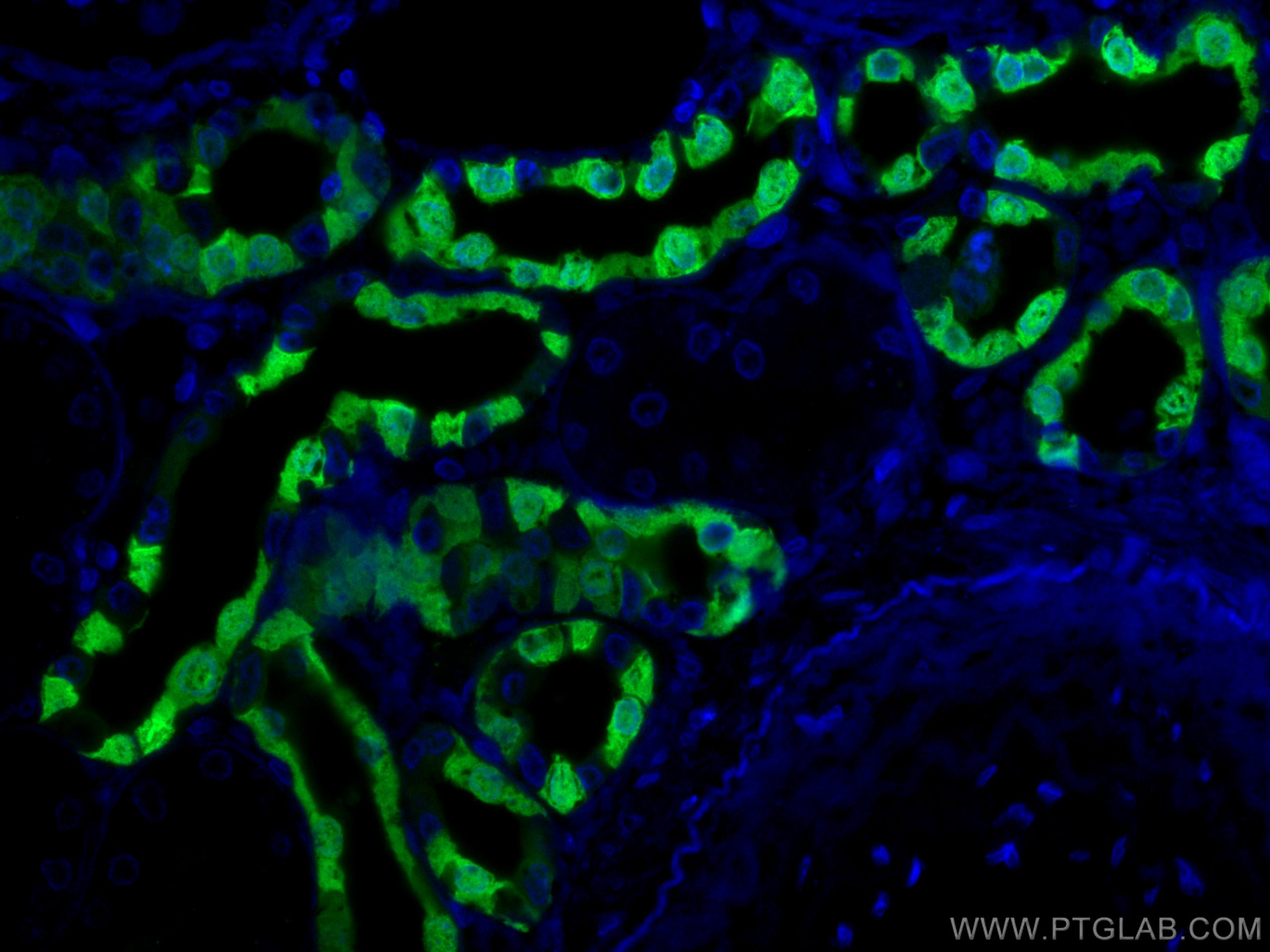 Immunofluorescence (IF) / fluorescent staining of human kidney tissue using Calbindin-D28k Polyclonal antibody (14479-1-AP)