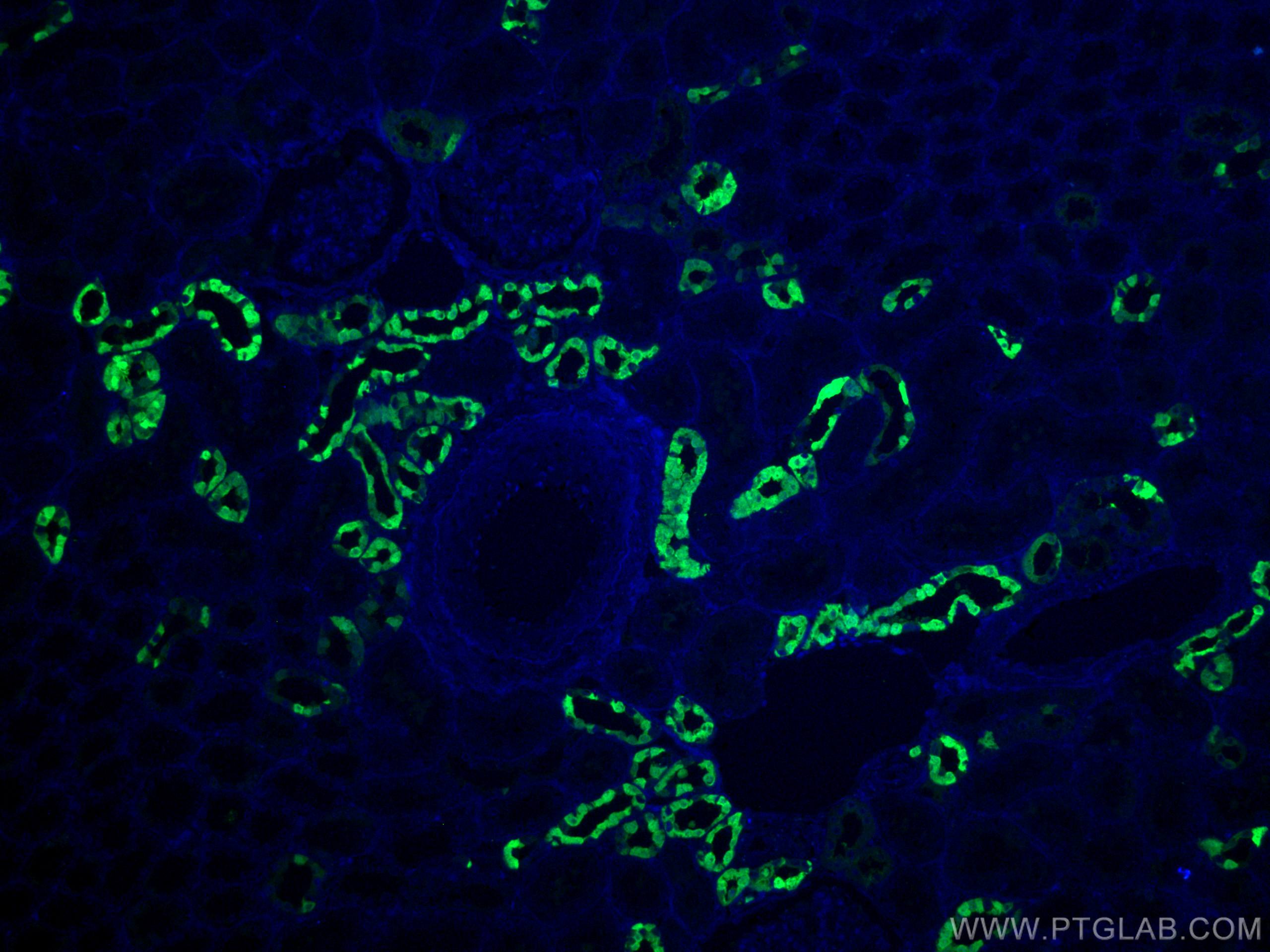 Immunofluorescence (IF) / fluorescent staining of human kidney tissue using Calbindin-D28k Polyclonal antibody (14479-1-AP)