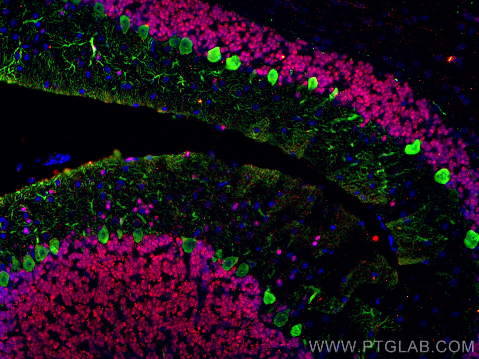 IF Staining of mouse cerebellum using 14479-1-AP