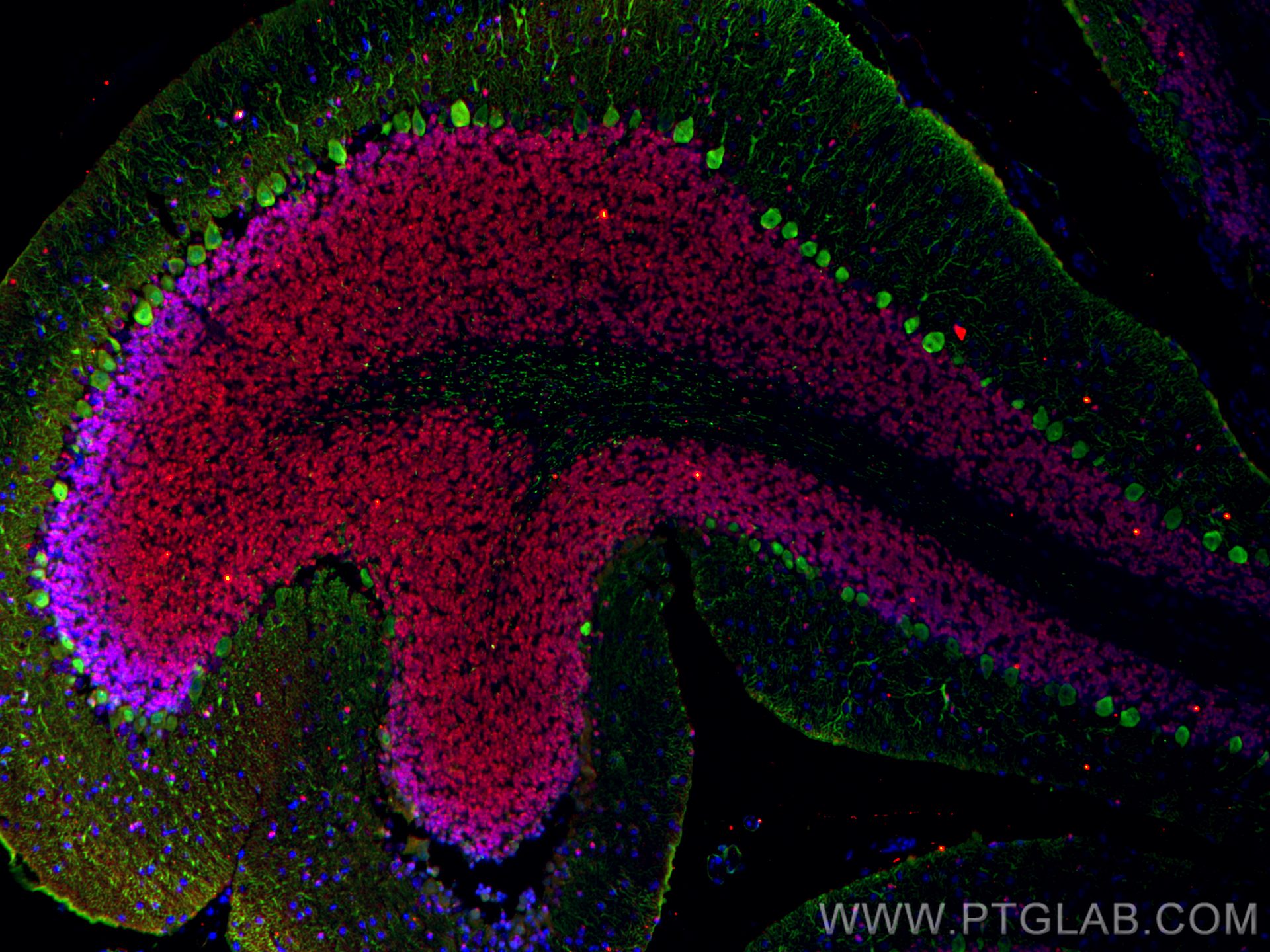 Immunofluorescence (IF) / fluorescent staining of mouse cerebellum tissue using Calbindin-D28k Polyclonal antibody (14479-1-AP)