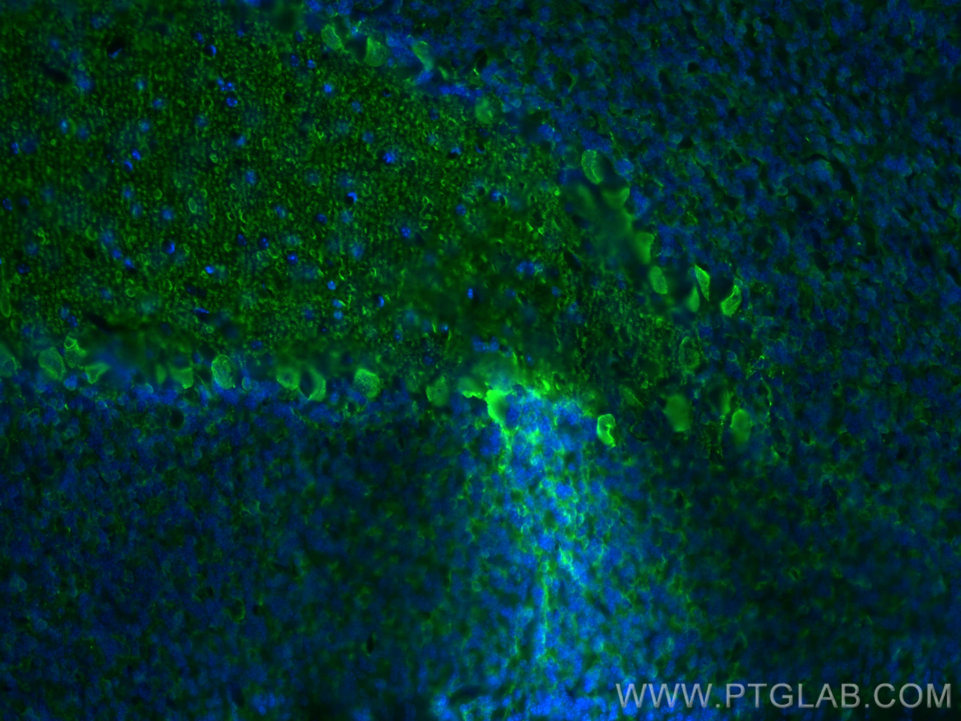 IF Staining of mouse cerebellum using 14479-1-AP