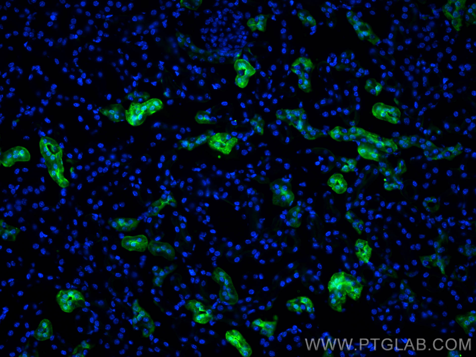 Immunofluorescence (IF) / fluorescent staining of mouse kidney tissue using Calbindin-D28k Polyclonal antibody (14479-1-AP)