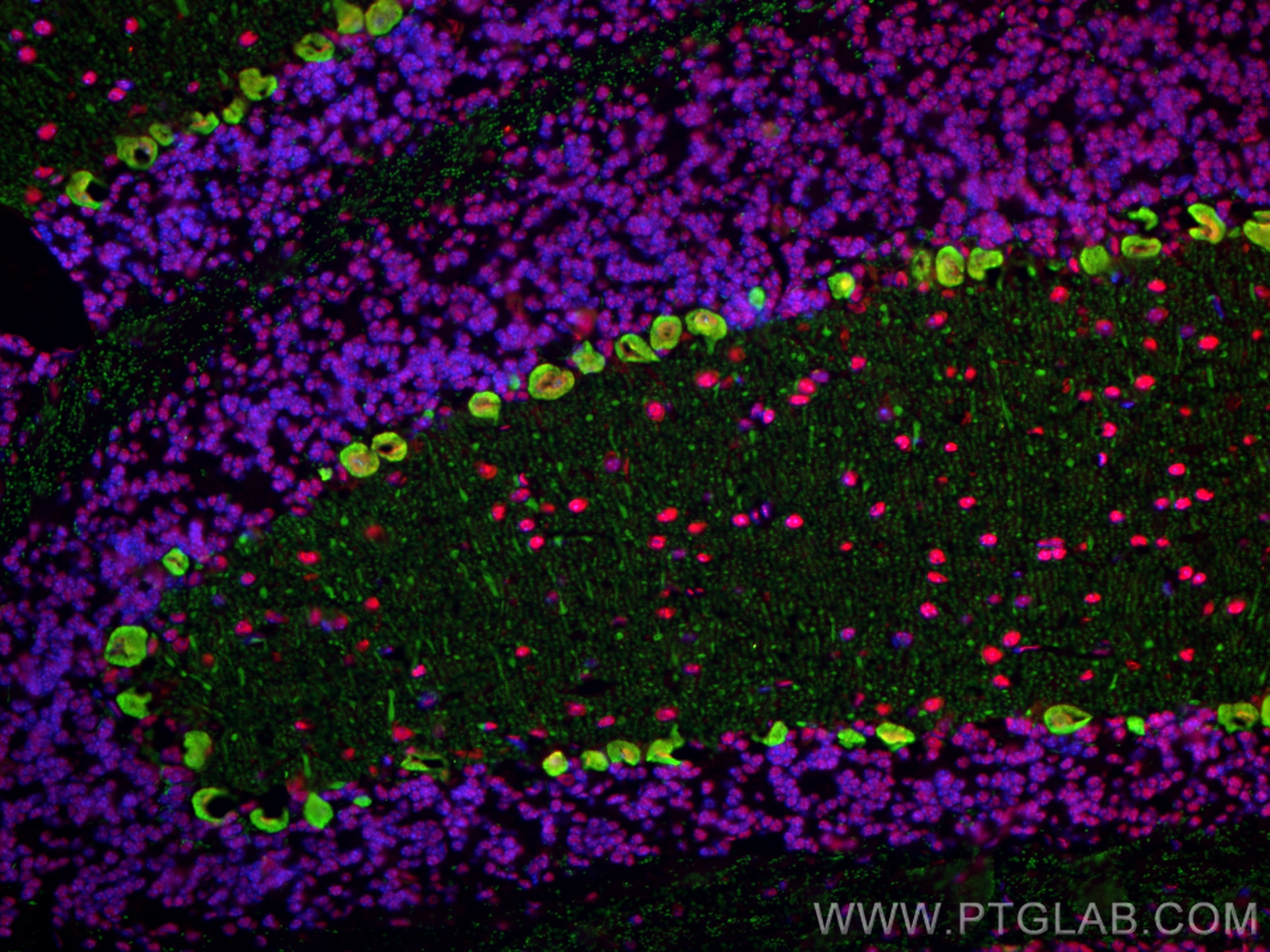 Immunofluorescence (IF) / fluorescent staining of mouse cerebellum tissue using Calbindin-D28k Polyclonal antibody (14479-1-AP)