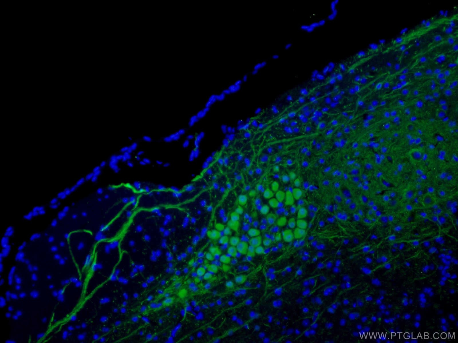 Immunofluorescence (IF) / fluorescent staining of mouse cerebellum tissue using Calbindin-D28k Polyclonal antibody (14479-1-AP)