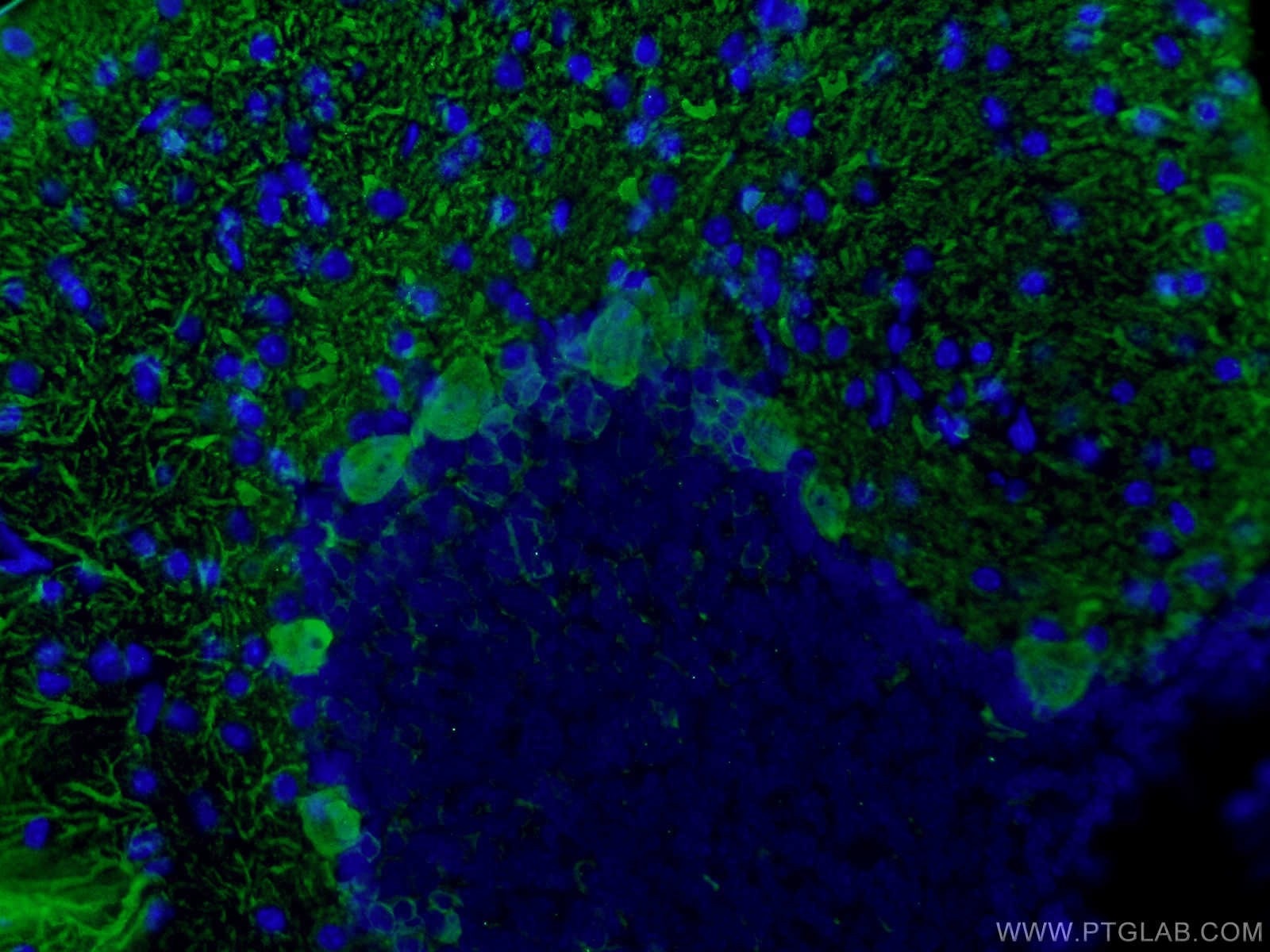 Immunofluorescence (IF) / fluorescent staining of mouse cerebellum tissue using Calbindin-D28k Polyclonal antibody (14479-1-AP)