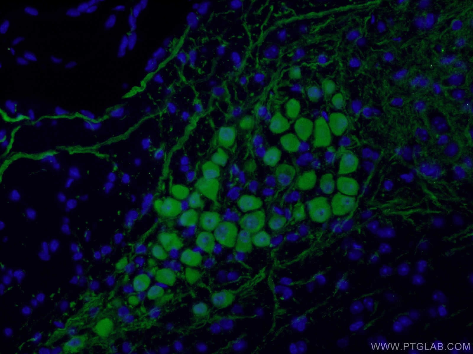 Immunofluorescence (IF) / fluorescent staining of mouse cerebellum tissue using Calbindin-D28k Polyclonal antibody (14479-1-AP)