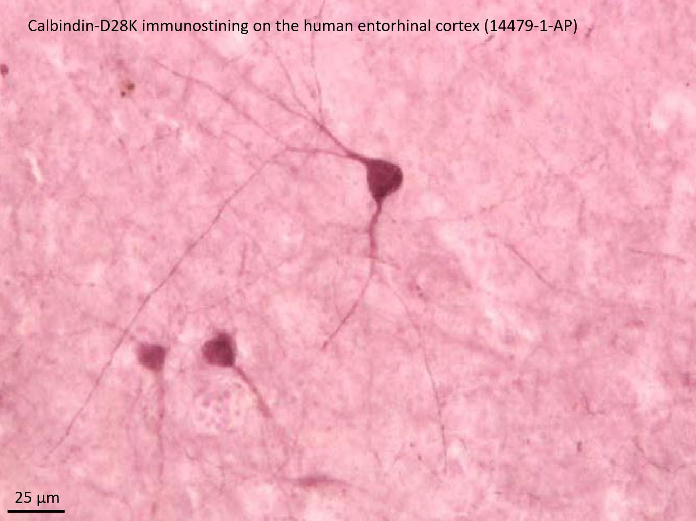 Immunohistochemistry (IHC) staining of hippocampus using Calbindin-D28k Polyclonal antibody (14479-1-AP)