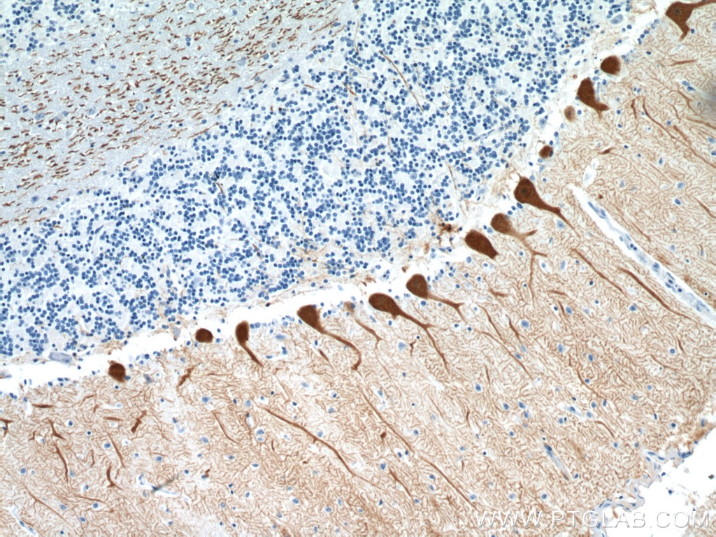 Immunohistochemistry (IHC) staining of human cerebellum tissue using Calbindin-D28k Polyclonal antibody (14479-1-AP)