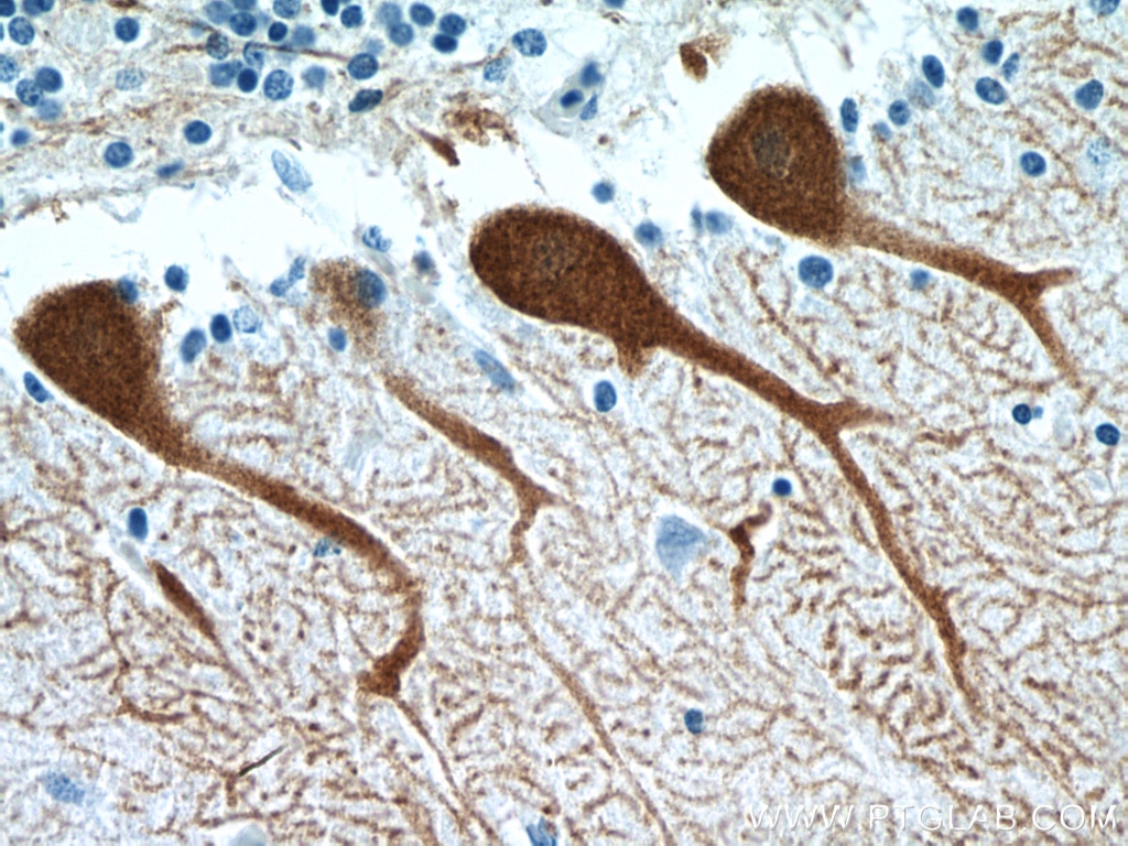 Immunohistochemistry (IHC) staining of human cerebellum tissue using Calbindin-D28k Polyclonal antibody (14479-1-AP)