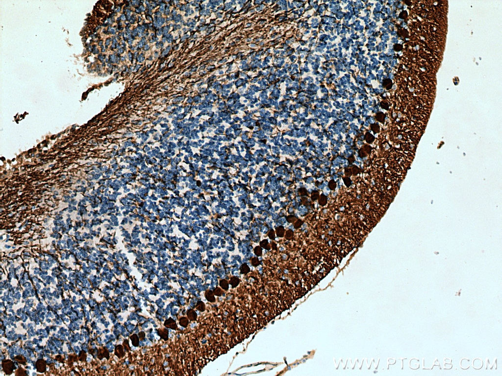 Immunohistochemistry (IHC) staining of mouse cerebellum tissue using Calbindin-D28k Polyclonal antibody (14479-1-AP)