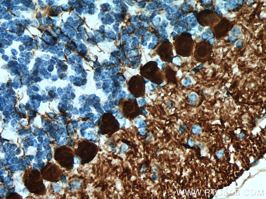 Immunohistochemistry (IHC) staining of mouse cerebellum tissue using Calbindin-D28k Polyclonal antibody (14479-1-AP)