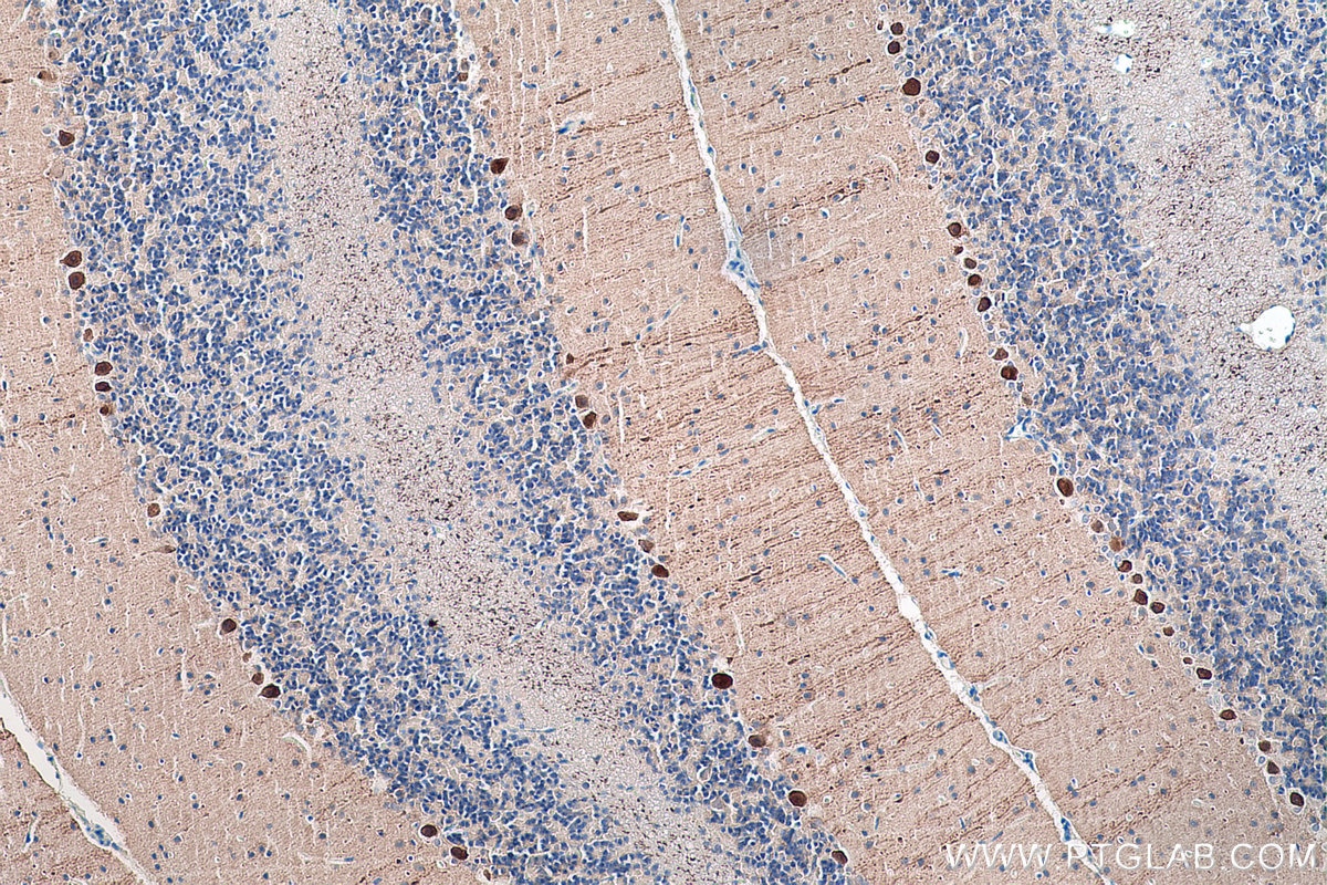 IHC staining of rat cerebellum using 14479-1-AP