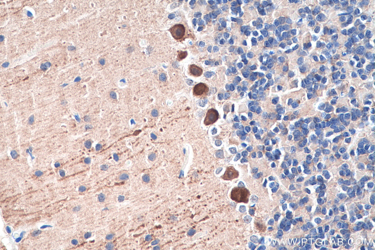Immunohistochemistry (IHC) staining of rat cerebellum tissue using Calbindin-D28k Polyclonal antibody (14479-1-AP)
