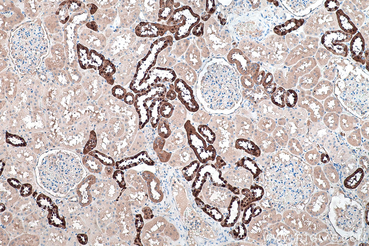 IHC staining of human kidney using 14479-1-AP